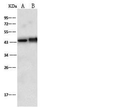 Invitrogen Doublecortin Polyclonal Antibody 100 &mu;L; Unconjugated:Antibodies,