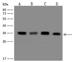Invitrogen DEGS1 Polyclonal Antibody 100 &mu;L; Unconjugated:Antibodies,