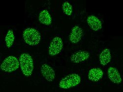 Invitrogen DEK Polyclonal Antibody 100 &mu;L; Unconjugated:Antibodies,