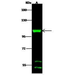 Invitrogen DHTKD1 Polyclonal Antibody 100 &mu;L; Unconjugated:Antibodies,