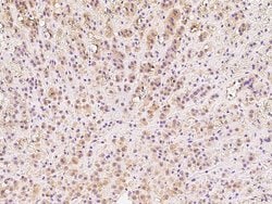 Invitrogen DIMT1 Polyclonal Antibody 100 &mu;L; Unconjugated:Antibodies,