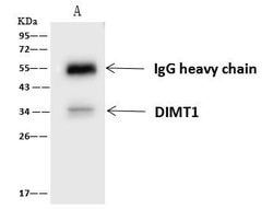 Invitrogen DIMT1 Polyclonal Antibody 100 &mu;L; Unconjugated:Antibodies,