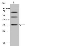Invitrogen DIMT1 Polyclonal Antibody 100 &mu;L; Unconjugated:Antibodies,