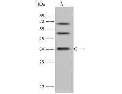 Invitrogen DIMT1 Polyclonal Antibody 100 &mu;L; Unconjugated:Antibodies,