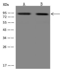 Invitrogen DIXDC1 Polyclonal Antibody 100 &mu;L; Unconjugated:Antibodies,