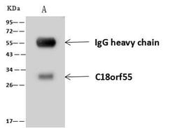 Invitrogen DNAJB11 Polyclonal Antibody 100 &mu;L; Unconjugated:Antibodies,