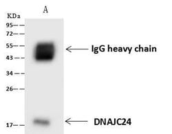 Invitrogen DNAJC24 Polyclonal Antibody 100 &mu;L; Unconjugated:Antibodies,