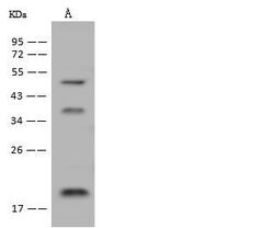 Invitrogen DNAJC24 Polyclonal Antibody 100 &mu;L; Unconjugated:Antibodies,