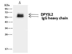 Invitrogen CRMP2 Polyclonal Antibody 100 μL; Unconjugated:Antibodies,