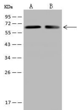 Invitrogen CRMP2 Polyclonal Antibody 100 μL; Unconjugated:Antibodies,