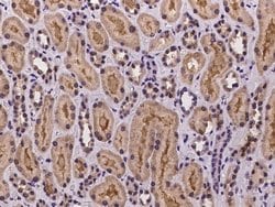 Invitrogen DTYMK Polyclonal Antibody 100 &mu;L; Unconjugated:Antibodies,