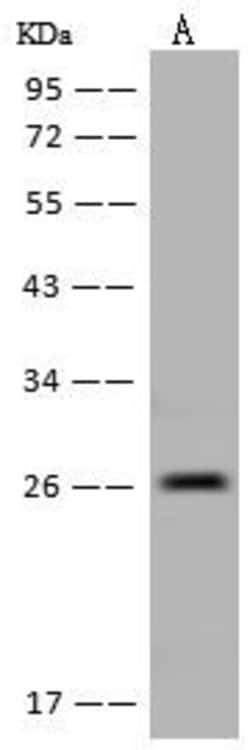 Invitrogen DTYMK Polyclonal Antibody 100 &mu;L; Unconjugated:Antibodies,