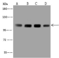 Invitrogen EEF2K Polyclonal Antibody 100 &mu;L; Unconjugated:Antibodies,