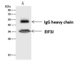 Invitrogen eIF3j Polyclonal Antibody 100 &mu;L; Unconjugated:Antibodies,