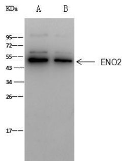 Invitrogen NSE Polyclonal Antibody 100 &mu;L | Buy Online | Invitrogen&trade; | Fisher Scientific