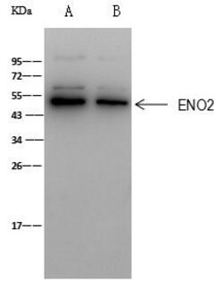 Invitrogen NSE Polyclonal Antibody 100 &mu;L | Buy Online | Invitrogen&trade; | Fisher Scientific
