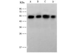Invitrogen NSE Polyclonal Antibody 100 &mu;L | Buy Online | Invitrogen&trade; | Fisher Scientific