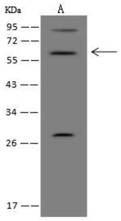Invitrogen EOGT Polyclonal Antibody 100 μL; Unconjugated:Antibodies,