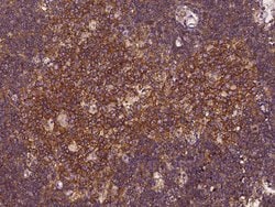 Invitrogen EPS15 Polyclonal Antibody 100 &mu;L; Unconjugated:Antibodies,