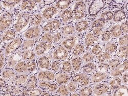 Invitrogen EPS15 Polyclonal Antibody 100 &mu;L; Unconjugated:Antibodies,