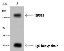 Invitrogen EPS15 Polyclonal Antibody 100 &mu;L; Unconjugated:Antibodies,