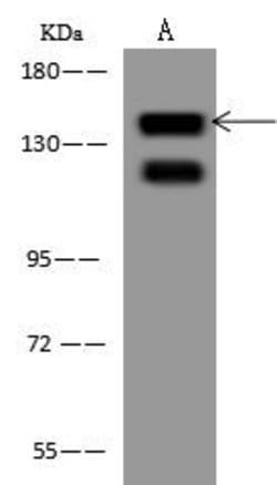 Invitrogen EPS15 Polyclonal Antibody 100 &mu;L; Unconjugated:Antibodies,