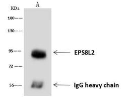 Invitrogen EPS8L2 Polyclonal Antibody 100 &mu;L | Buy Online | Invitrogen&trade; | Fisher Scientific