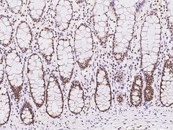 Invitrogen EXOSC7 Polyclonal Antibody 100 &mu;L | Buy Online | Invitrogen&trade; | Fisher Scientific