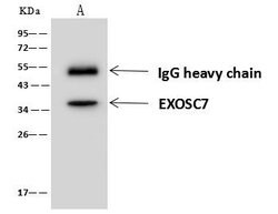 Invitrogen EXOSC7 Polyclonal Antibody 100 &mu;L | Buy Online | Invitrogen&trade; | Fisher Scientific