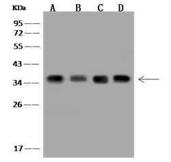 Invitrogen EXOSC7 Polyclonal Antibody 100 &mu;L | Buy Online | Invitrogen&trade; | Fisher Scientific