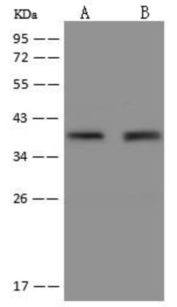 Invitrogen FAM76B Polyclonal Antibody 100 &mu;L; Unconjugated:Antibodies,