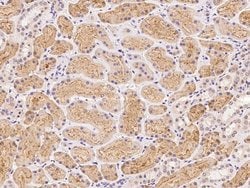 Invitrogen FNIP2 Polyclonal Antibody 100 &mu;L; Unconjugated:Antibodies,