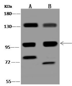 Invitrogen FNIP2 Polyclonal Antibody 100 &mu;L; Unconjugated:Antibodies,