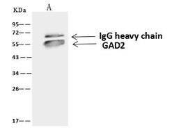 Invitrogen GAD65 Polyclonal Antibody 100 &mu;L; Unconjugated:Antibodies,