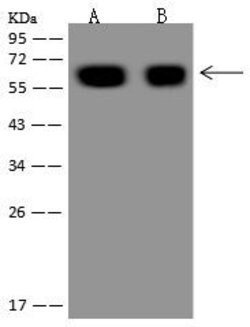 Invitrogen GAD65 Polyclonal Antibody 100 &mu;L; Unconjugated:Antibodies,
