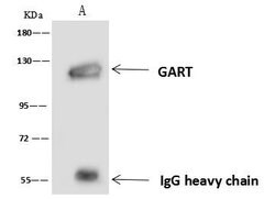 Invitrogen GART Polyclonal Antibody 100 &mu;L; Unconjugated:Antibodies,