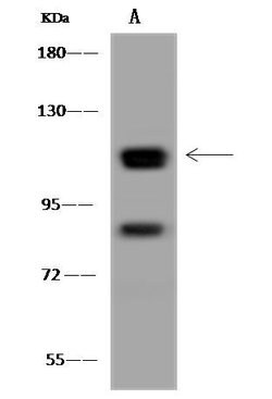 Invitrogen GART Polyclonal Antibody 100 &mu;L; Unconjugated:Antibodies,