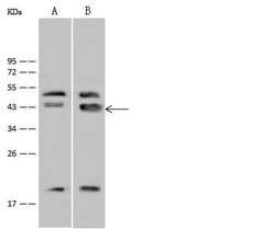 Invitrogen GATA4 Polyclonal Antibody 100 &mu;L; Unconjugated:Antibodies,
