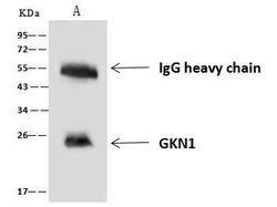 Invitrogen GKN1 Polyclonal Antibody 100 &mu;L; Unconjugated:Antibodies,