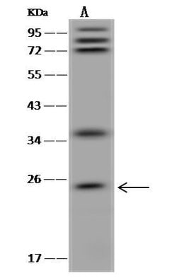 Invitrogen GKN1 Polyclonal Antibody 100 &mu;L; Unconjugated:Antibodies,