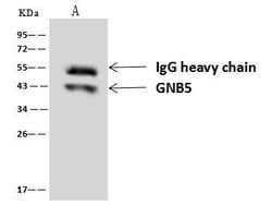 Invitrogen GNB5 Polyclonal Antibody 100 &mu;L; Unconjugated:Antibodies,