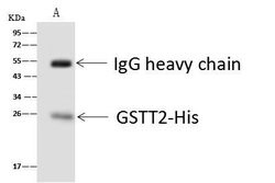 Invitrogen GSTT2B Polyclonal Antibody 100 &mu;L; Unconjugated:Antibodies,