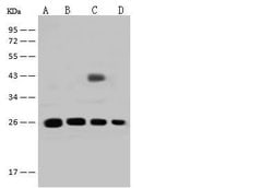 Invitrogen GSTT2B Polyclonal Antibody 100 &mu;L; Unconjugated:Antibodies,