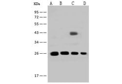 Invitrogen GSTT2B Polyclonal Antibody 100 &mu;L; Unconjugated:Antibodies,