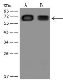 HAUS3 Rabbit anti-Human, Polyclonal, Invitrogen 100 &mu;L; Unconjugated:Antibodies,