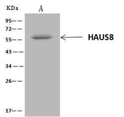 Invitrogen HICE1 Polyclonal Antibody 100 &mu;L; Unconjugated:Antibodies,
