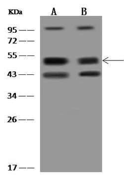 Invitrogen HICE1 Polyclonal Antibody 100 &mu;L; Unconjugated:Antibodies,
