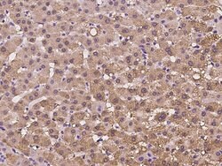 Invitrogen HIBCH Polyclonal Antibody 100 &mu;L; Unconjugated:Antibodies,