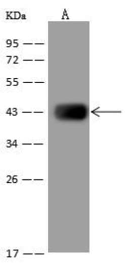 Invitrogen HIBCH Polyclonal Antibody 100 &mu;L; Unconjugated:Antibodies,
