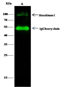 Invitrogen HK1 Polyclonal Antibody 100 &mu;L | Buy Online | Invitrogen&trade; | Fisher Scientific